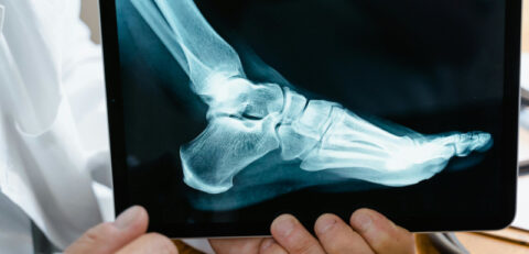 injury 1